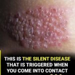 9 Signs of Diabetes That Appear at Night