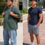 Everyone With Fatty Liver Has This in Common! A Hidden Sign You Should Know About